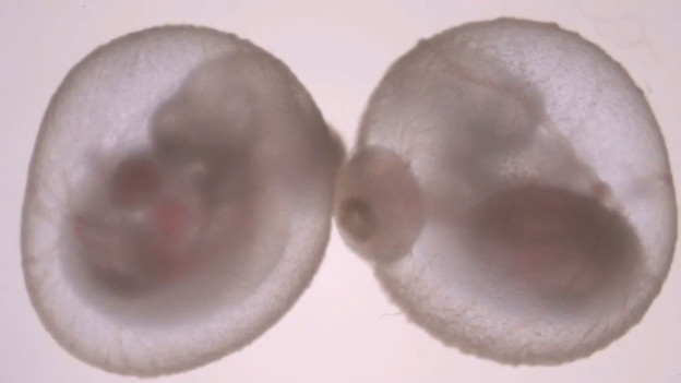 VIDEO: Embrij raste u umjetnoj maternici