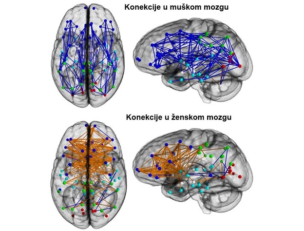 Ženski mozak je umreženiji od muškog