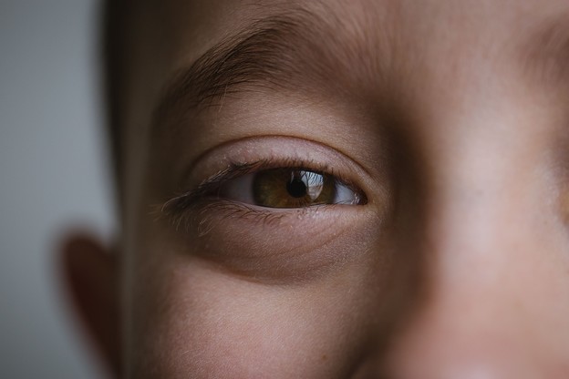 AI savršeno prepoznaje autizam iz slike oka