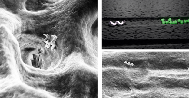 Dentalni nanobotovi za dubinsko čišćenje zubi